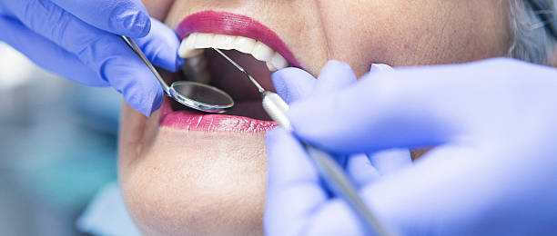 Best Emergency Wisdom Tooth Extraction in Presquille, LA